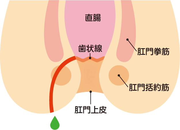 いぼ 痔 治す 体操