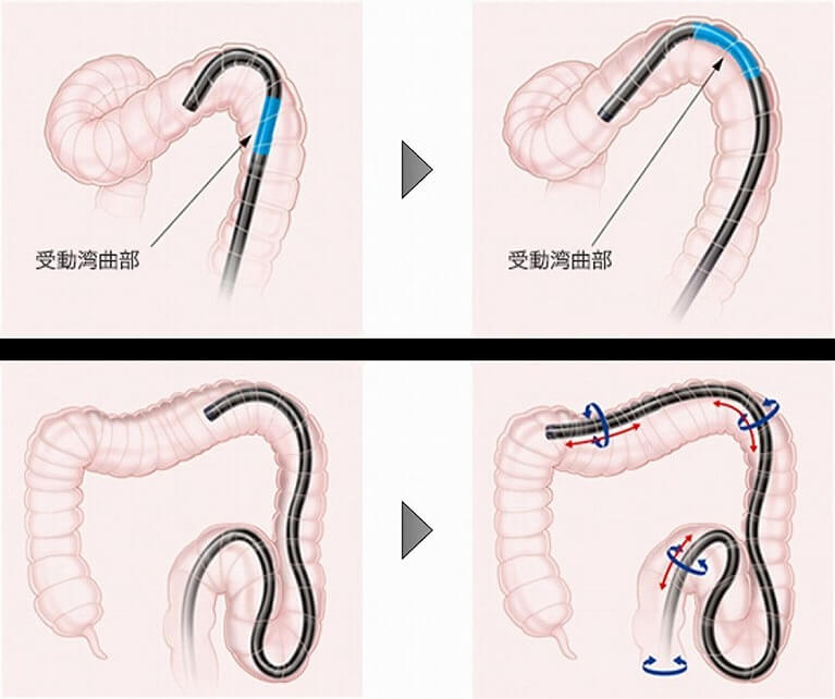 最新の内視鏡スコープを搭載